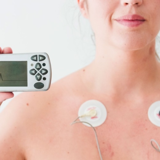 logo holter ecg 24 ore 3 derivazioni